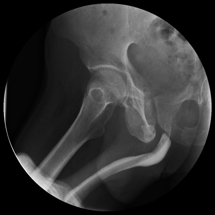 Normal Urethrogram