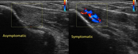 Radiology Quiz 60908 | Radiopaedia.org