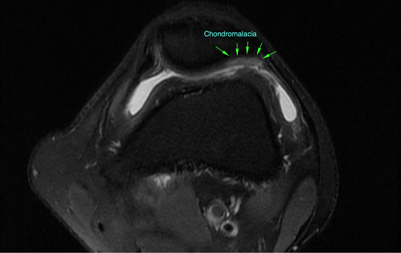 Image | Radiopaedia.org