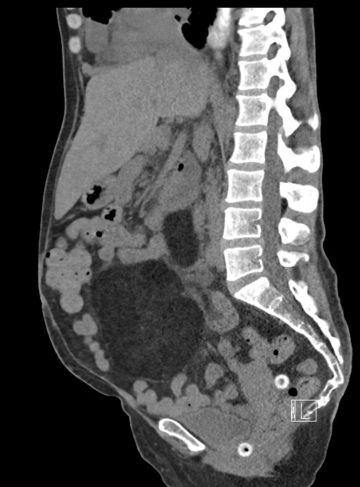 Image | Radiopaedia.org