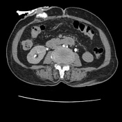 Images | Radiopaedia.org