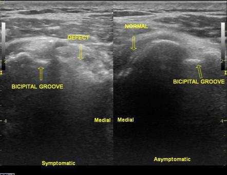 Image | Radiopaedia.org