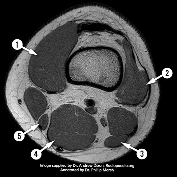 Image | Radiopaedia.org