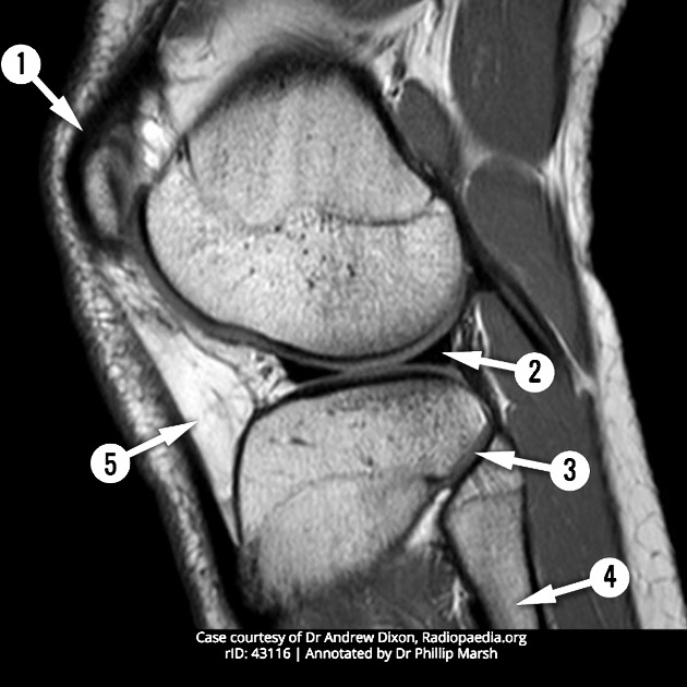 Anatomy of the Knee joint Quiz