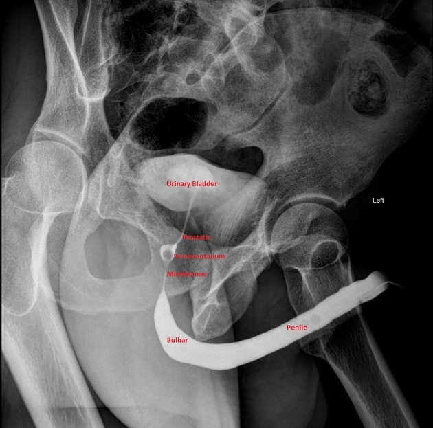 Urethrography Radiology Reference Article