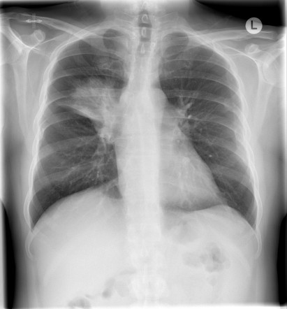 Radiology Quiz 61963 | Radiopaedia.org