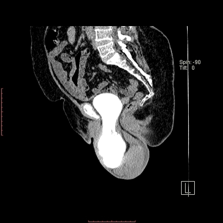 Viewing playlist: pelvis | Radiopaedia.org