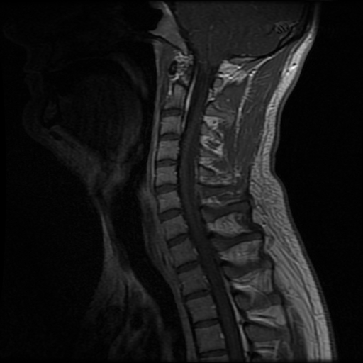 Image Radiopaedia Org