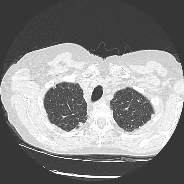 Radiology Quiz 62279 | Radiopaedia.org