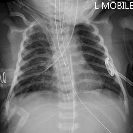 Radiology Quiz 23851 | Radiopaedia.org