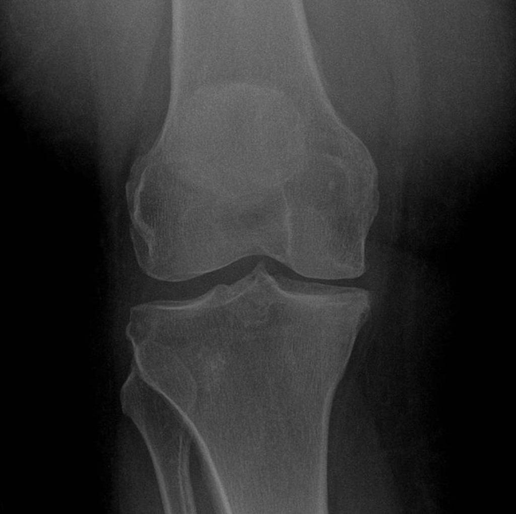 Radiology Quiz 9422 | Radiopaedia.org