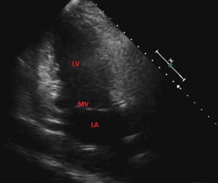 Point-of-care ultrasound (curriculum) | Radiology Reference Article ...