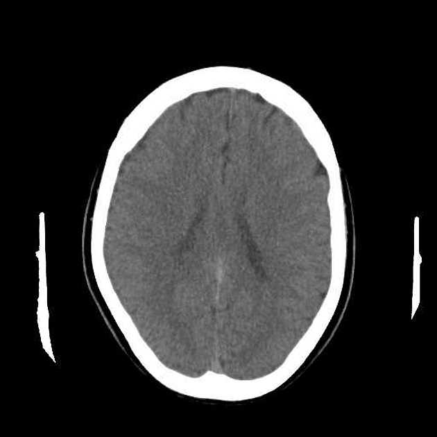 Radiology Quiz 62875 | Radiopaedia.org