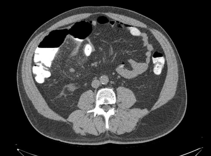 Radiology Quiz 62880 | Radiopaedia.org