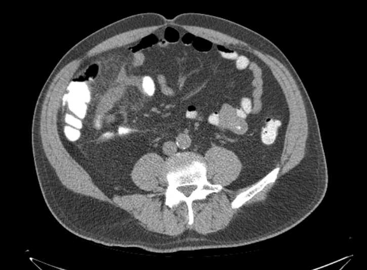 Radiology Quiz 62880 | Radiopaedia.org