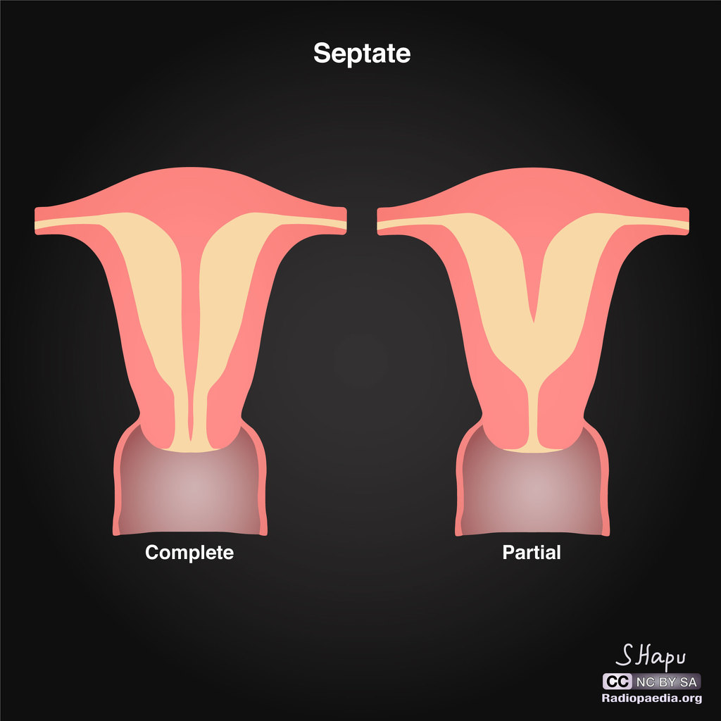 subseptate-concerned-and-confused-r-babybumps