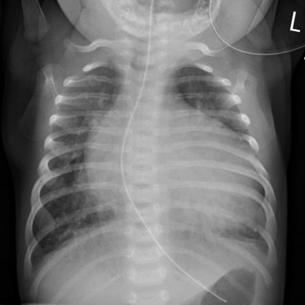 Radiology Quiz 23790 | Radiopaedia.org