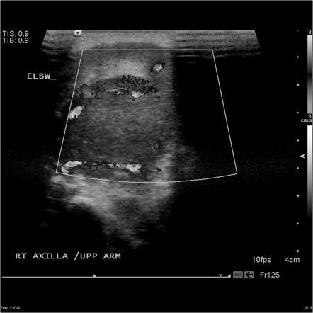 Playlist 'Muscle pathology' by Dr Jeremy Jones