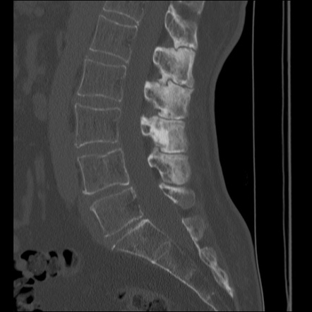 Radiology Quiz 63606 | Radiopaedia.org