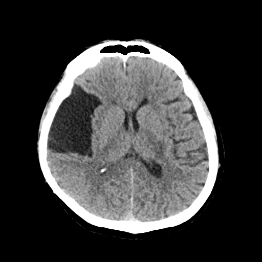 Radiology Quiz 63607 | Radiopaedia.org