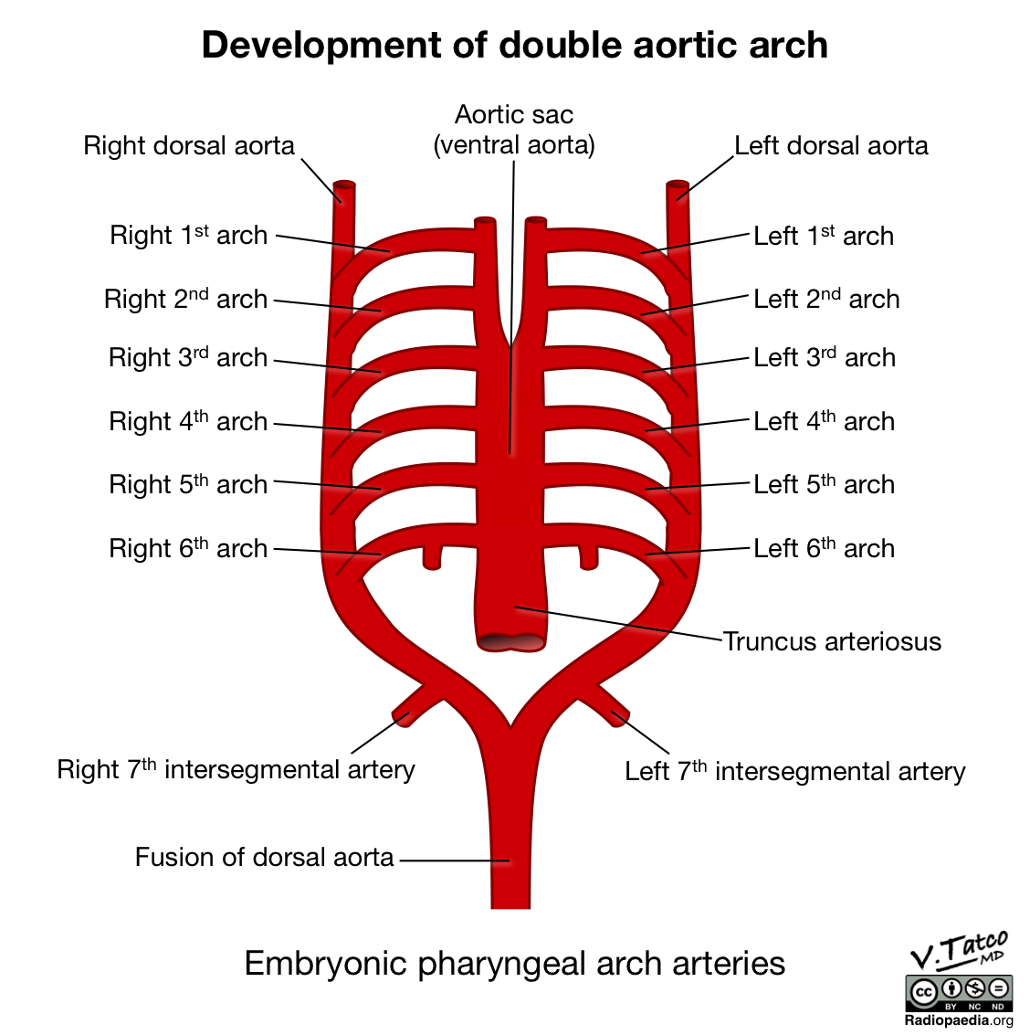 Seven rights. Aortic Arch. Aortic Arch Development. Arch of Aorta. Aortic Arch Branches.