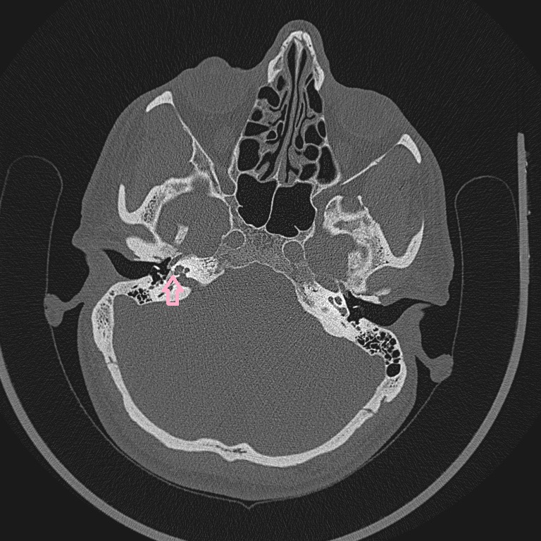 Image | Radiopaedia.org