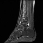 Viewing playlist: ANKLE MRI | Radiopaedia.org