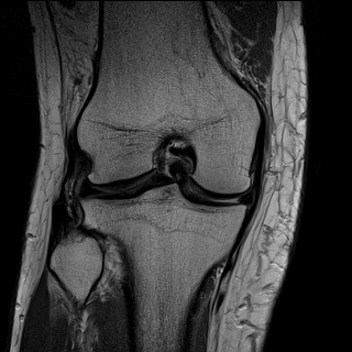 Radiology Quiz 63867  Radiopaedia.orgViewing playlist: Perfect 