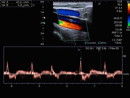 Image | Radiopaedia.org