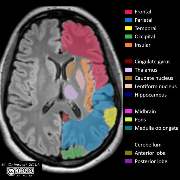 brain anatomy Quiz