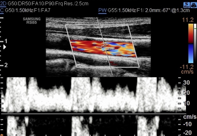  Ultrasound Physics Scanning AND Modes M Mode  C6557b9a869474df5812a8021e83c2_big_gallery