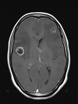 Viewing playlist: Module N-NKO | Radiopaedia.org