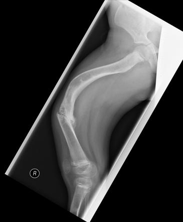 Rickets | Radiology Reference Article | Radiopaedia.org