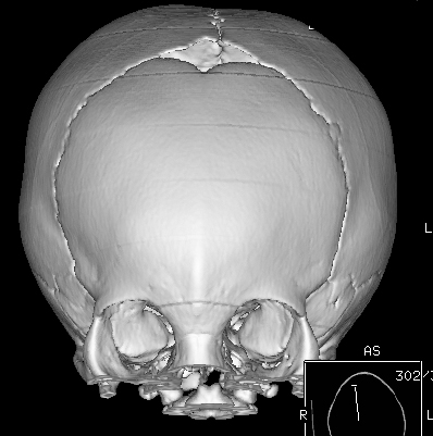 Image | Radiopaedia.org