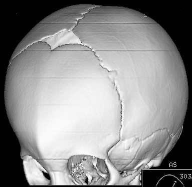 Image | Radiopaedia.org