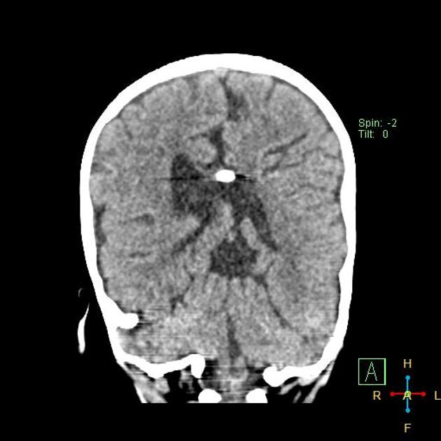 Radiology Quiz 24527