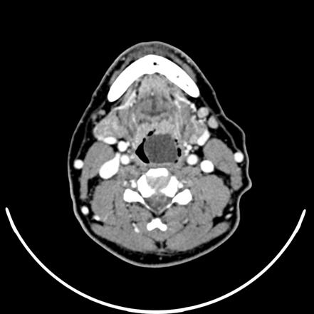 Image | Radiopaedia.org