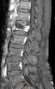 Viewing playlist: Exam cases | Radiopaedia.org