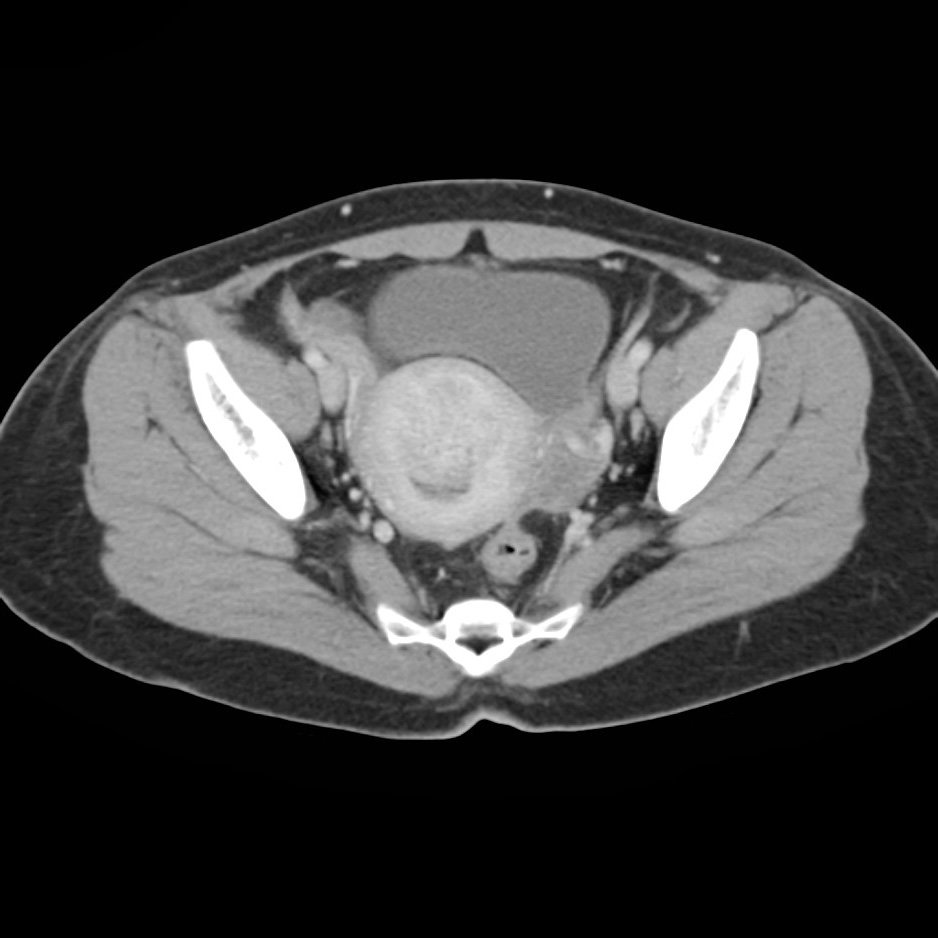 在庫僅少】 【裁断済】CT縦横無尽 健康・医学 - blogs.ergotron.com