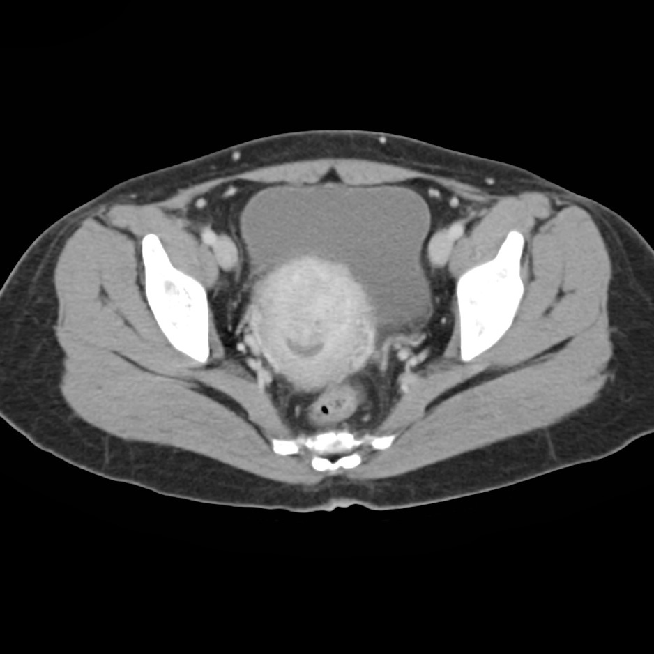 Radiology Quiz 9868 | Radiopaedia.org