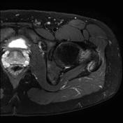 Viewing Playlist: Mri Hip 