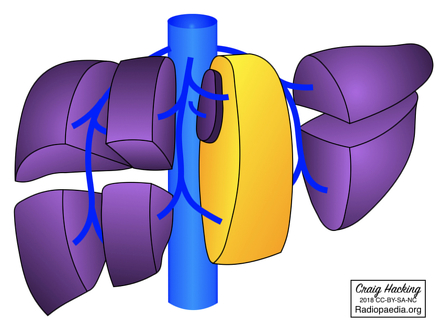 Image | Radiopaedia.org