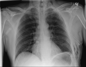 Viewing playlist: Chest | Radiopaedia.org