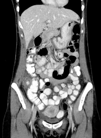 Playlist 'A rough night on call: abdominal CT in the ED' by Dr Michael ...