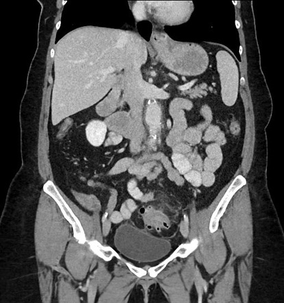 Playlist 'A rough night on call: abdominal CT in the ED' by Dr Michael ...