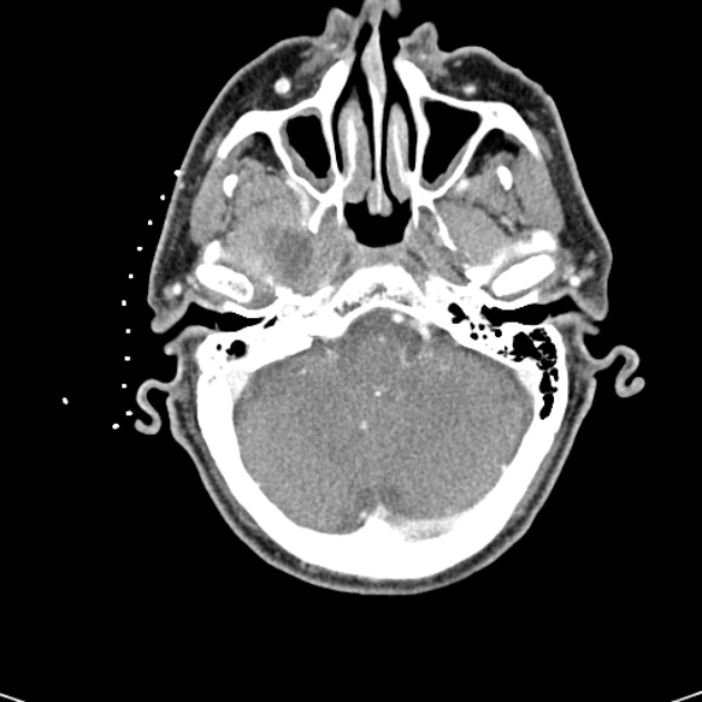 Radiology Quiz 25198 | Radiopaedia.org