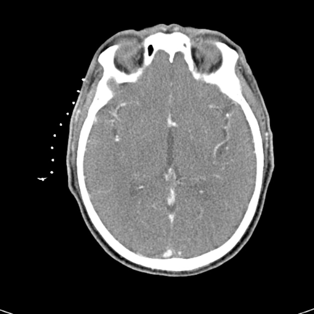 Radiology Quiz 25198 | Radiopaedia.org