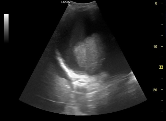  Ultrasound Physics Scanning AND Modes M Mode  5aa8ecd9ccc4605db44205e843e9ae_big_gallery