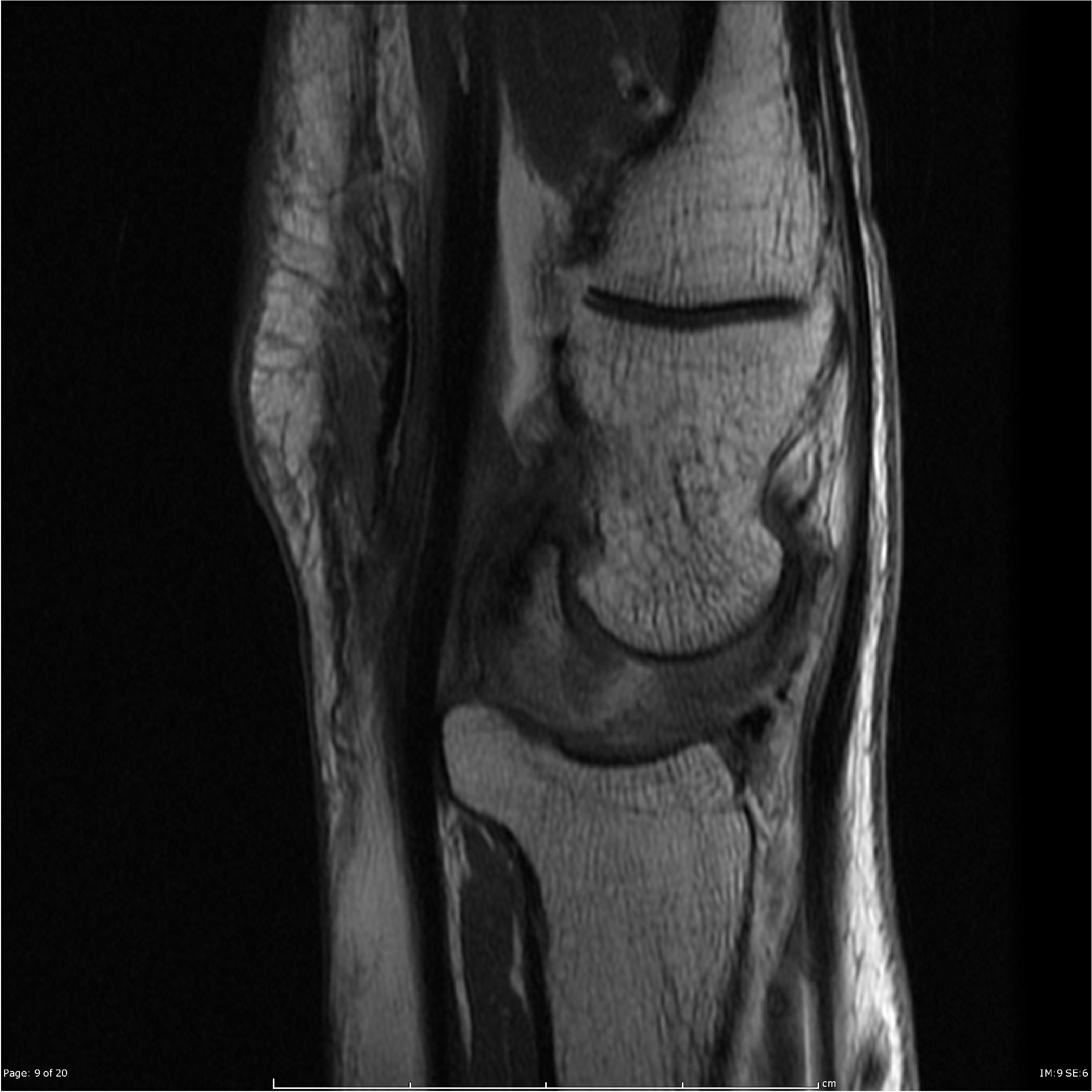 Radiology Quiz 25289  Radiopaedia.org