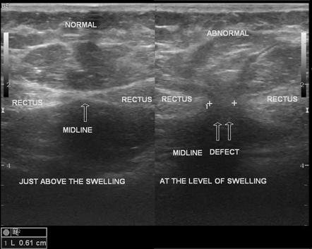 Image | Radiopaedia.org